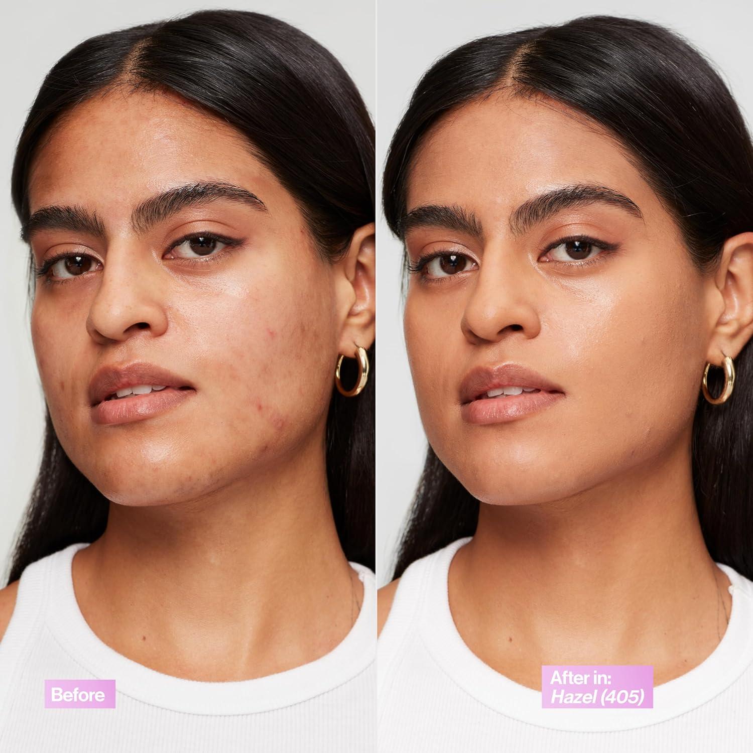 imageRevlon Illuminance Tinted Serum Triple Hyaluronic Acid Evens Out Skin Tone Over Time and Hydrates All Day SPF 15 417 Warm Caramel 094 fl ozHazel Beige