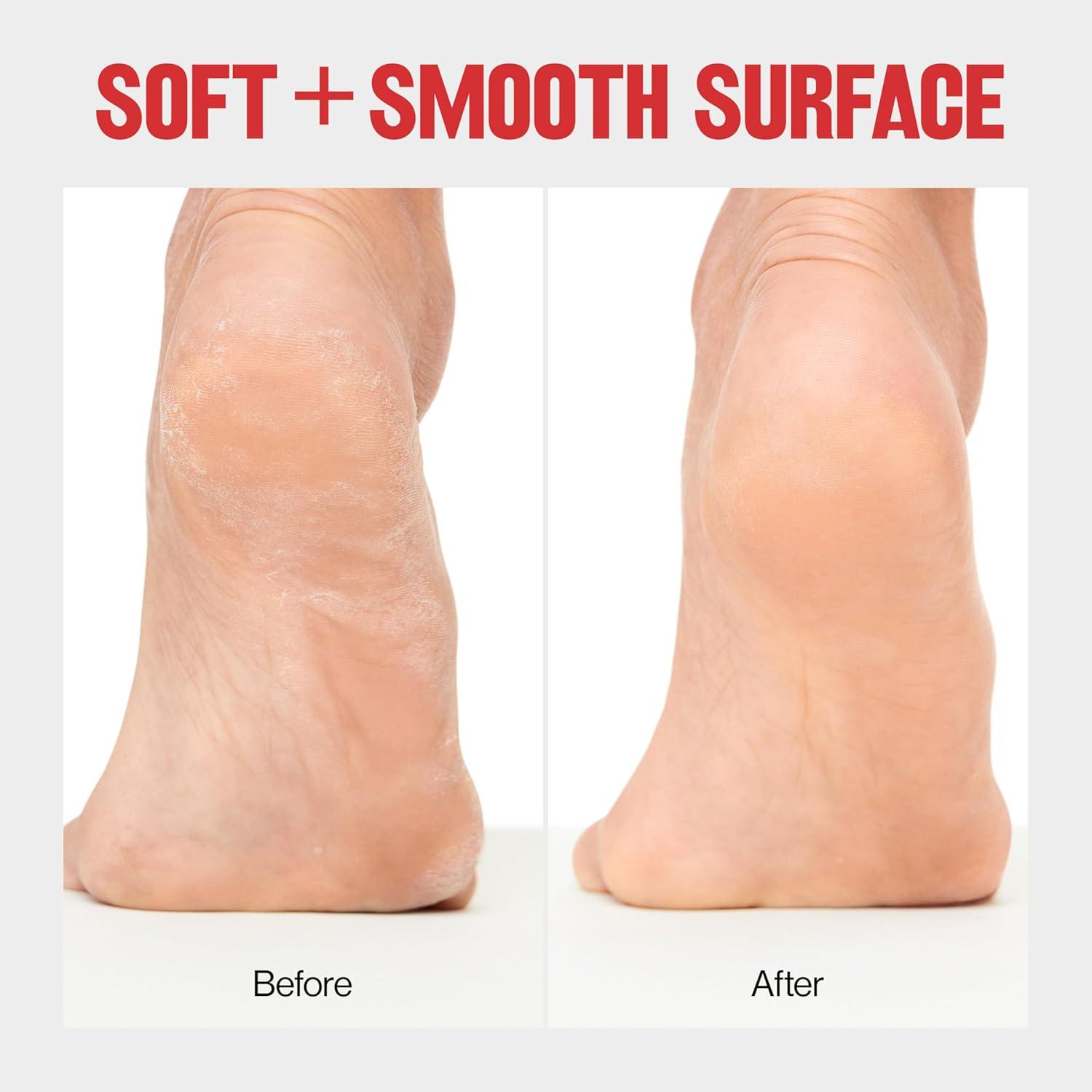 imageRevlon Callus Remover Foot File with NoMess Cover Gently Exfoliates and Smooths Feet Softens Calloused Areas 1 count